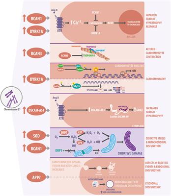 New Molecular and Organelle Alterations Linked to Down Syndrome Heart Disease